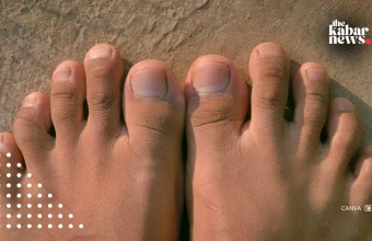 Is your second toe longer than your first? You may have Morton’s toe