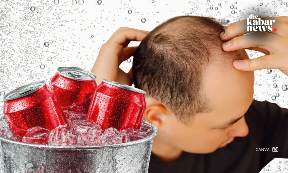 Sugary drinks may increase hair loss and anxiety risks in men, study finds