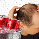 Sugary drinks may increase hair loss and anxiety risks in men, study finds