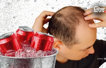 Sugary drinks may increase hair loss and anxiety risks in men, study finds